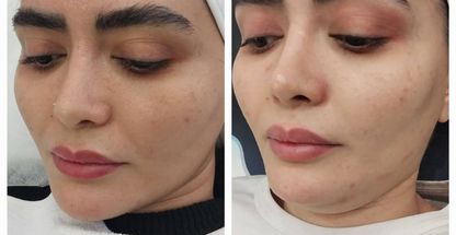 خدمات پوست صورت فرخی