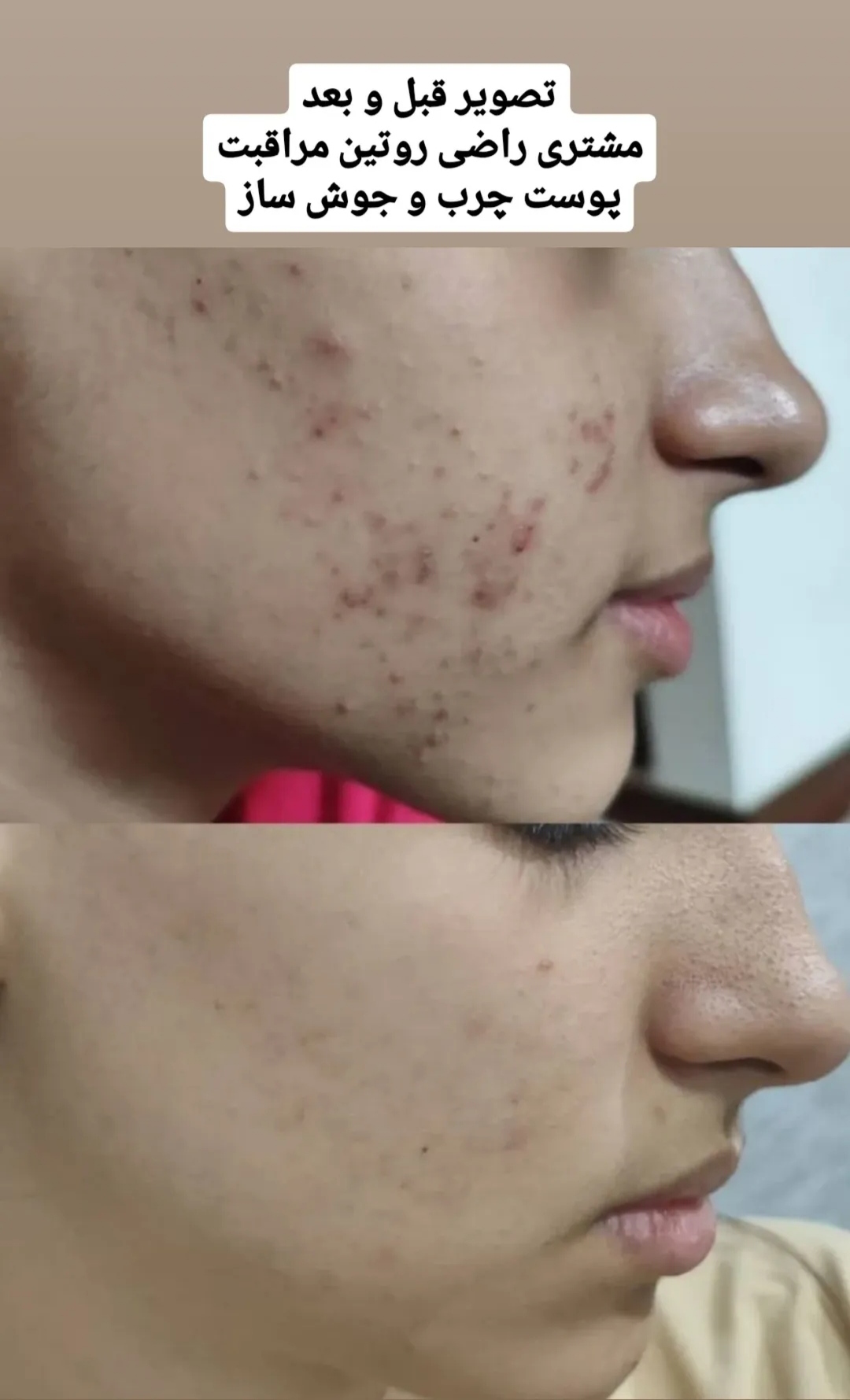 محصولات  پوست و مو دانش بنیان شهره