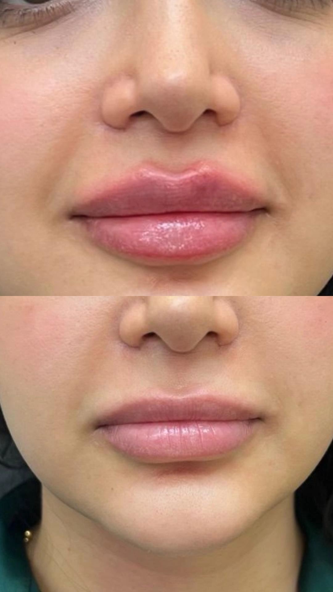کلینیک لیزر و زیبایی صورت و بدن مینوسا