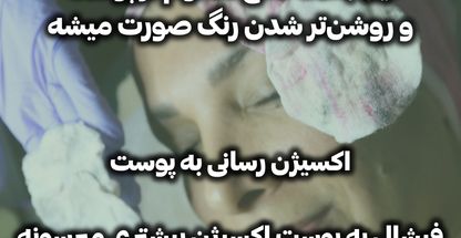 فشیال و اسکالپ زن روز