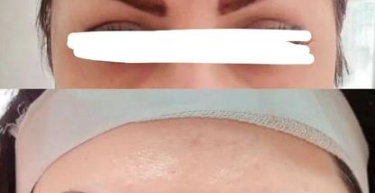 مرکز تزریق چربی و لیزر بدن شمس آباد