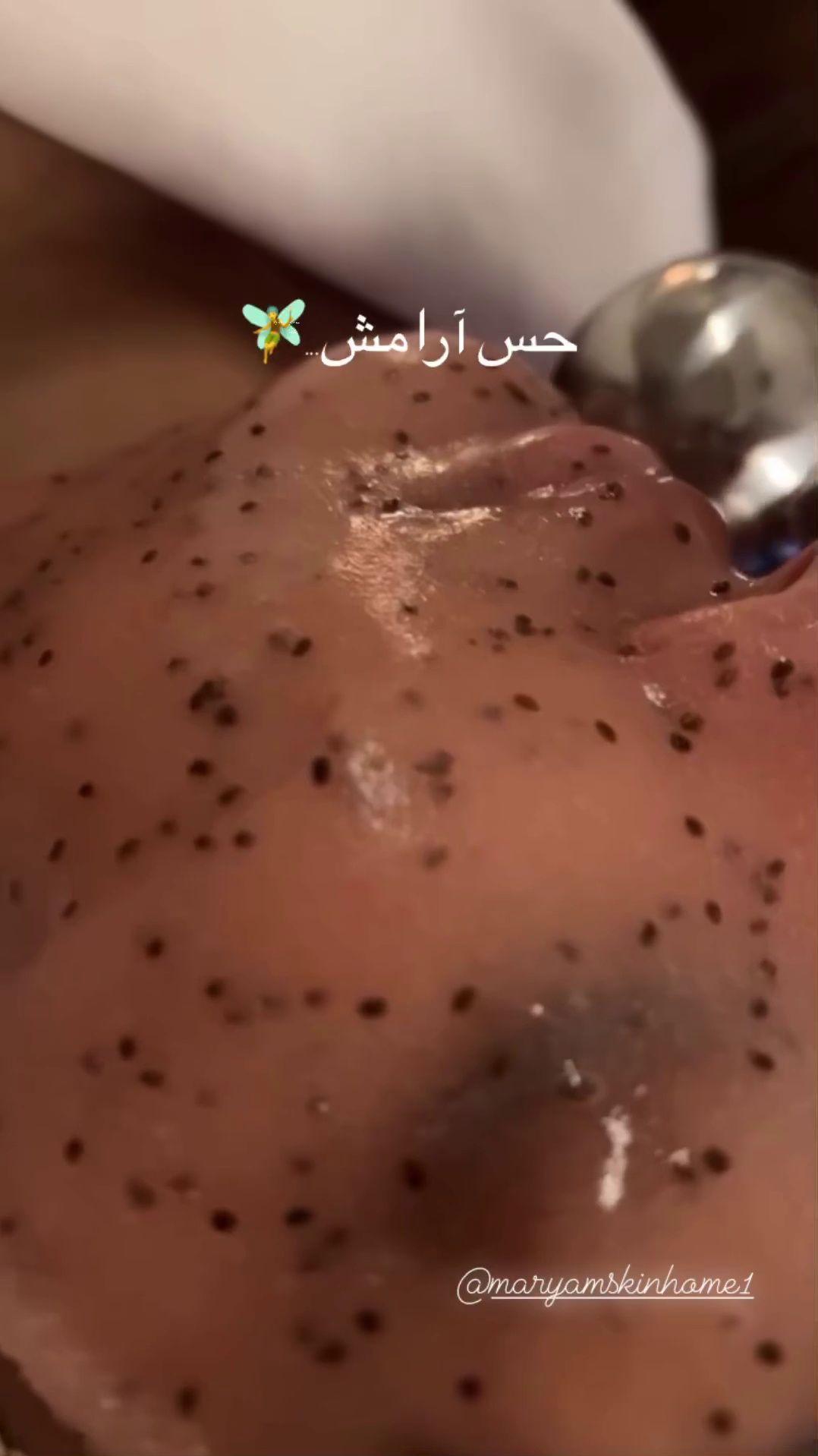 خانه پوست مریم