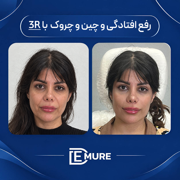 کلینیک زیبایی و جوانسازی دمور