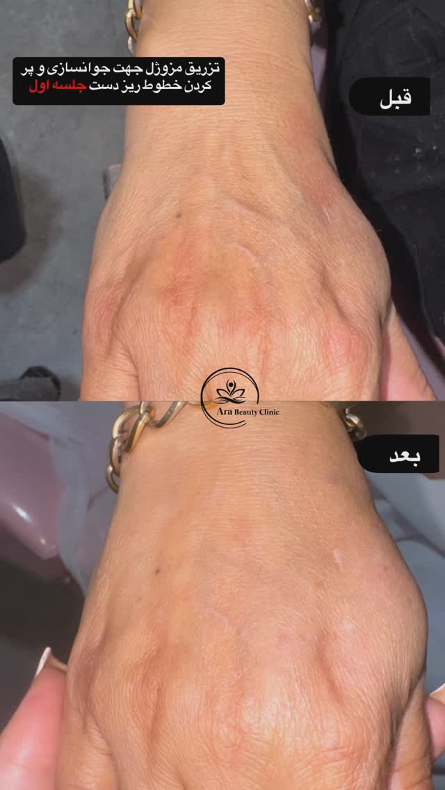 کلینیک پوست لیزر آرا