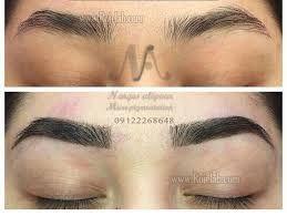 میگروپگمنتیشن یلدا