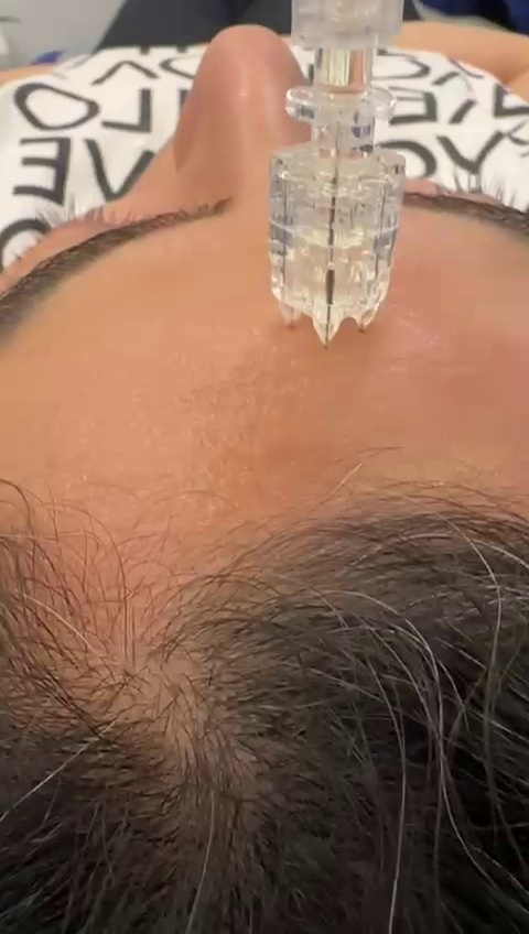 خدمات پوست و فیشال الهه
