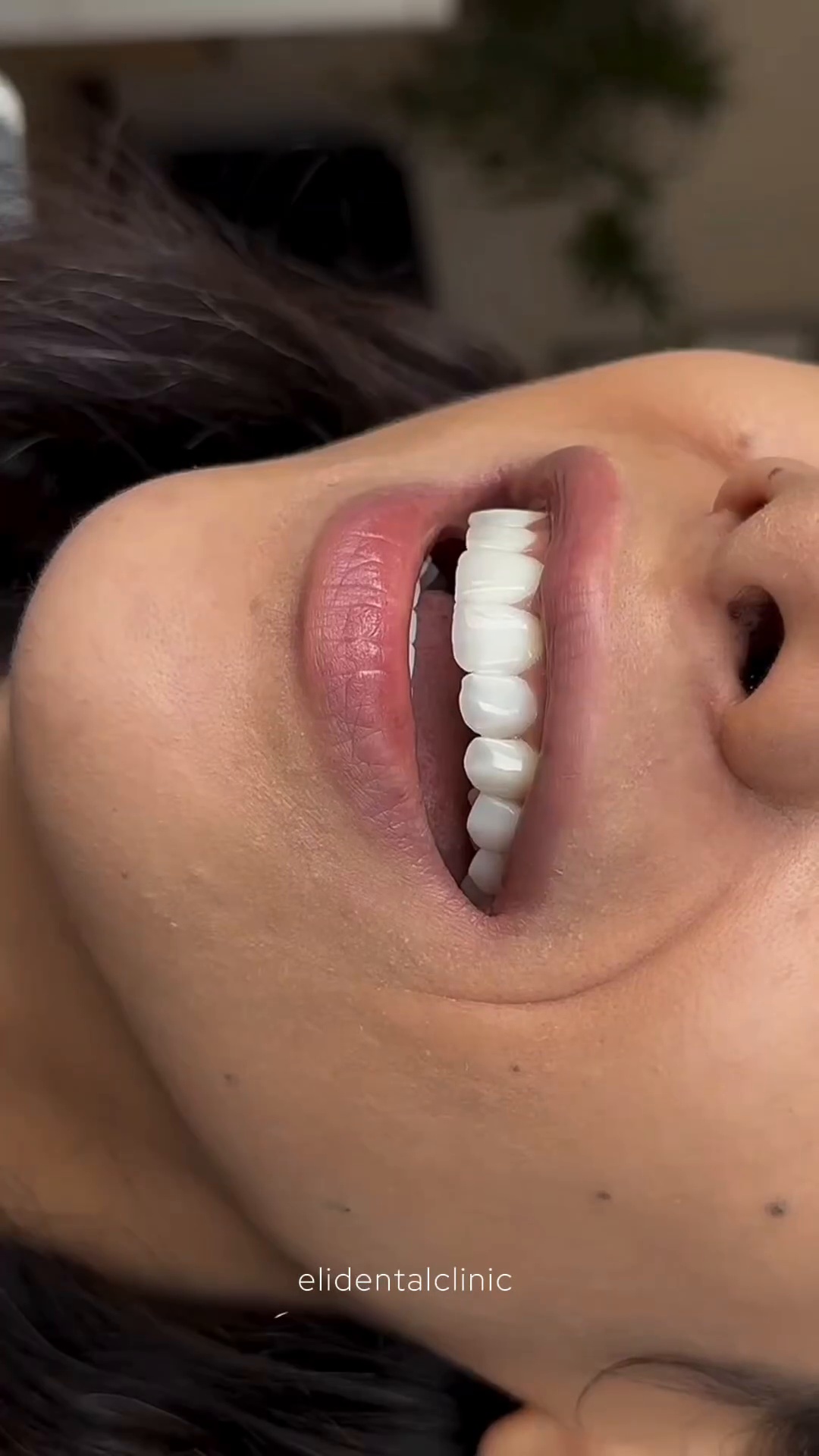 دندانپزشکی الی دنت ‌دیجیتال و اقساطی
