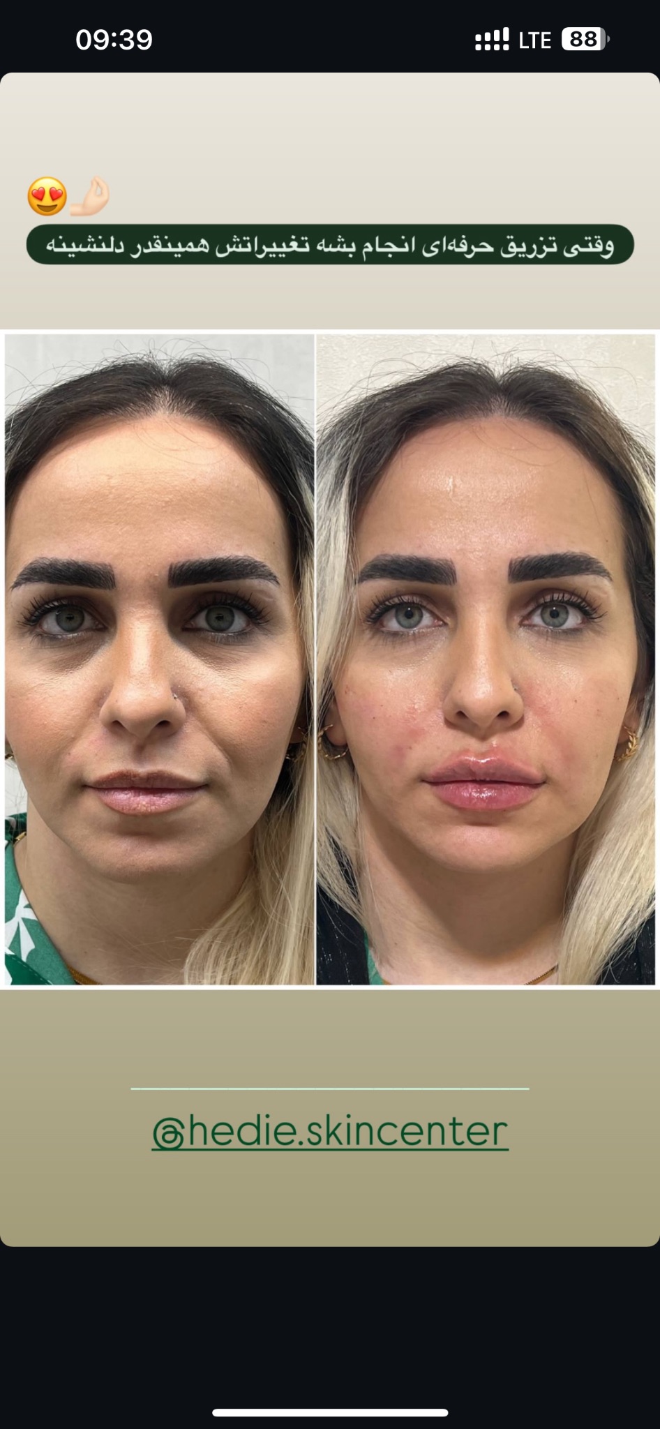 کلینیک زیبایی هدیه