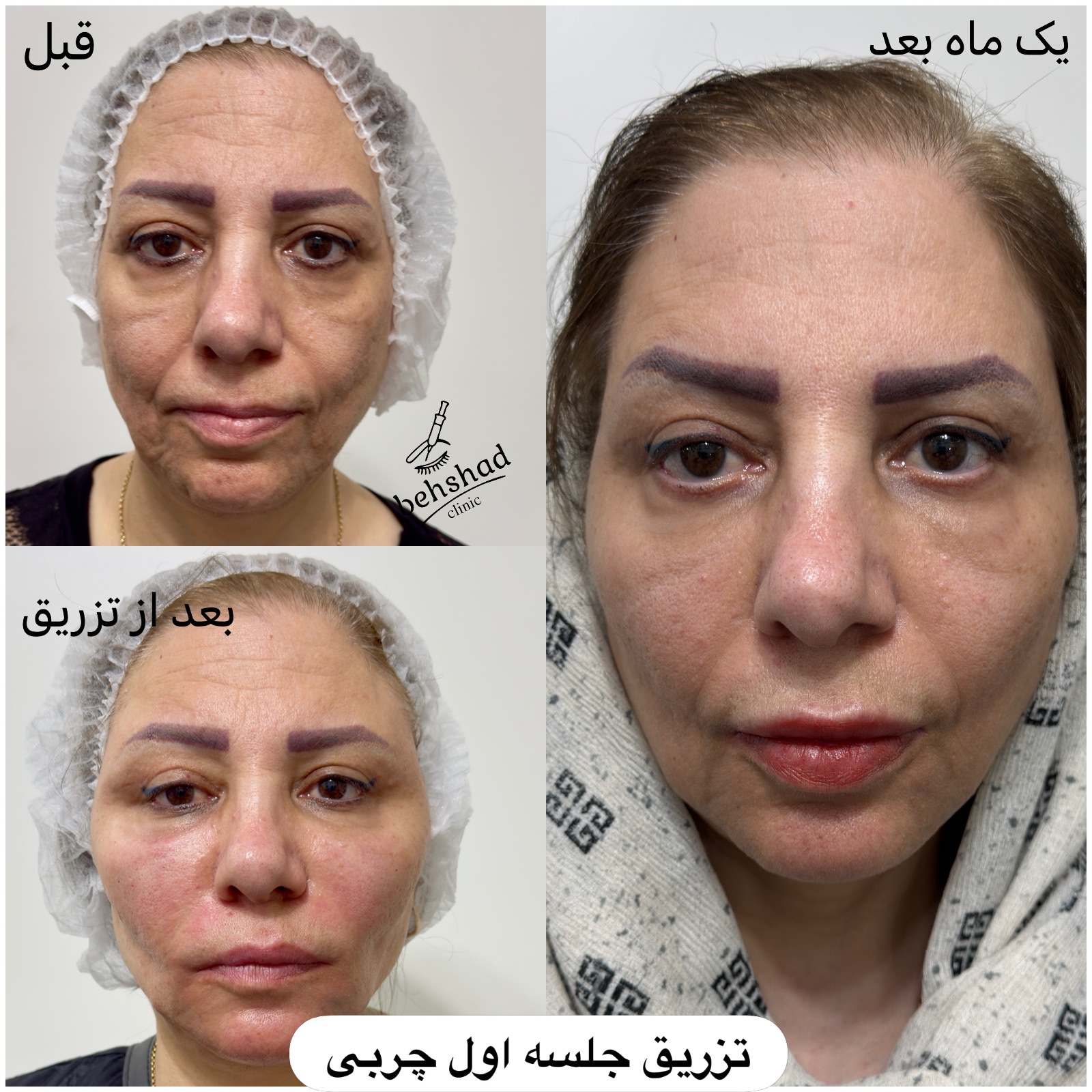 کلینیک تخصصی لیزر ،پوست و‌زیبایی بهشاد
