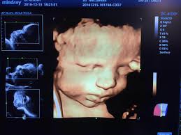 سونوگرافی دکتر امین عزیزیان