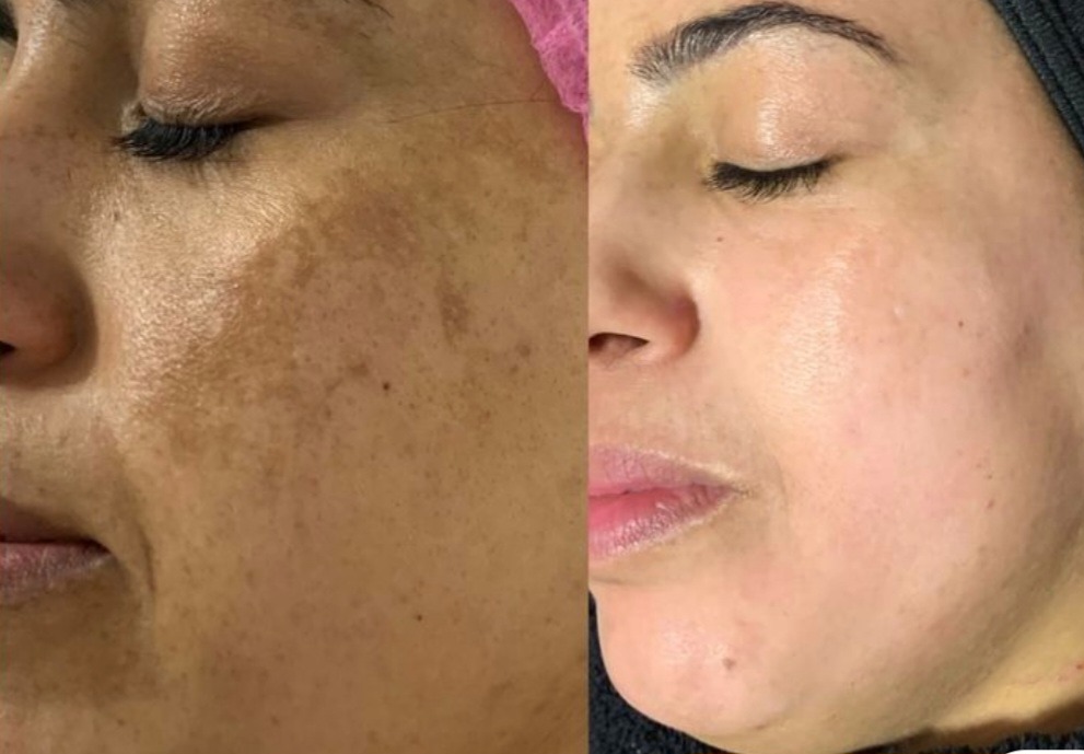 آرایش دائم و تاتو