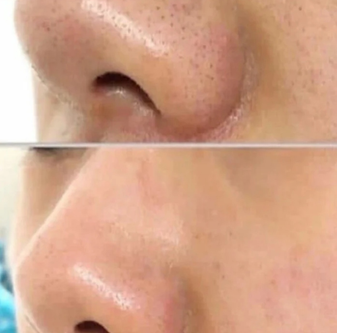 خدمات تخصصی پاکسازی و فیشال