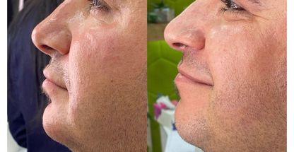 کلینیک پوست، مو و لیزر تی تی