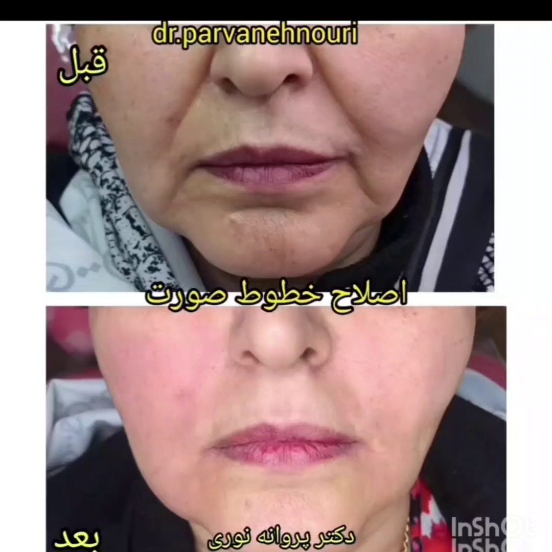 کلینیک زیبایی مرکز لیزر دکترپروانه نوری