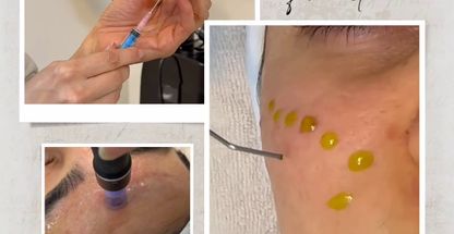 نورابل بیوتی( فشیال و پاکسازی پوست)