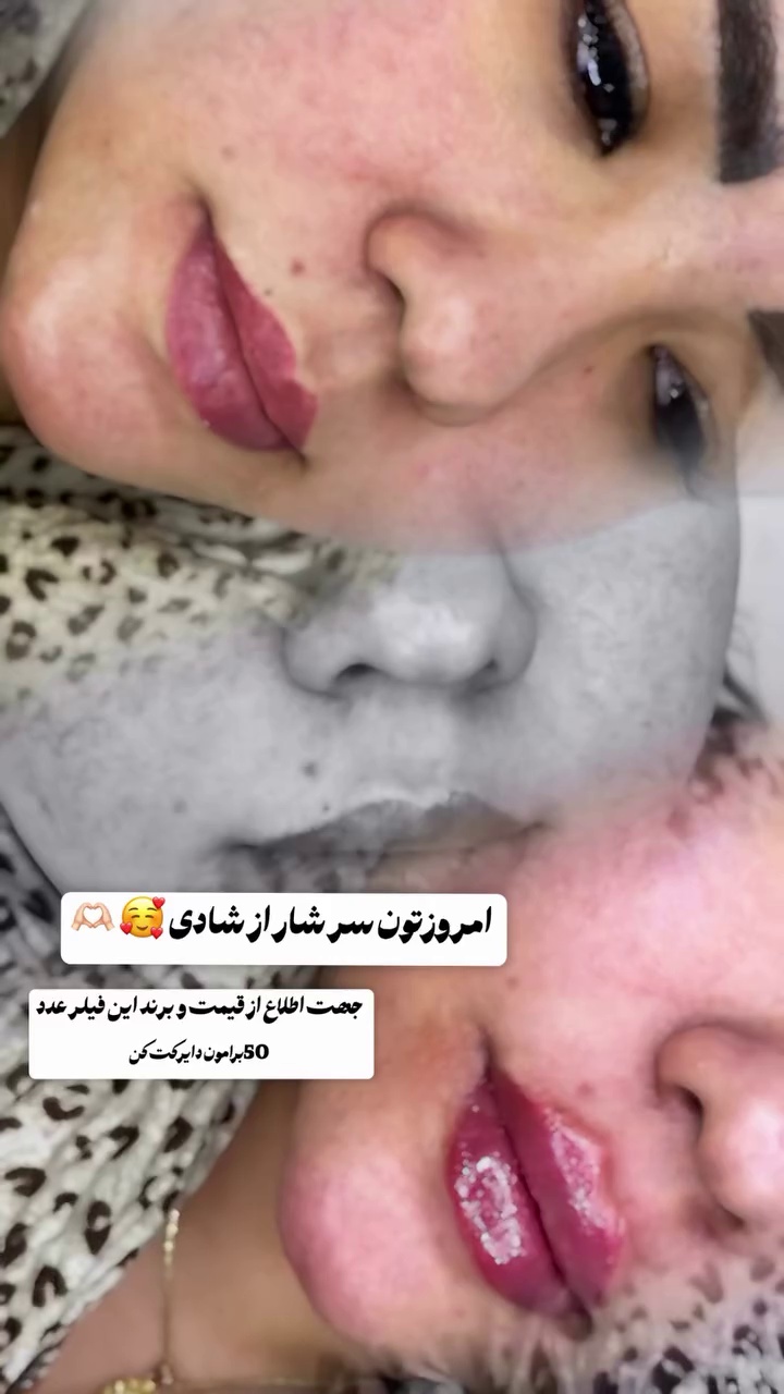 مطب زیبایی خانم محمدرضایی پوست ومو