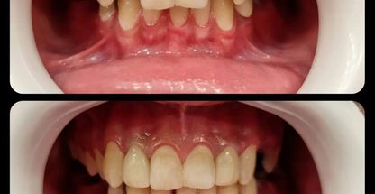 دکتر محمد کیخا جراح دندانپزشک