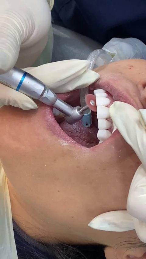 مركز ايمپلنت و زيبايى دکتر آنيتا کاظمى