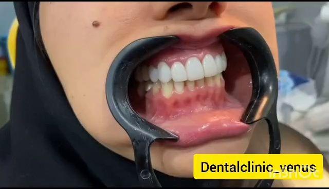 کلینیک دندانپزشکی ونوس (شعبه پاسداران)