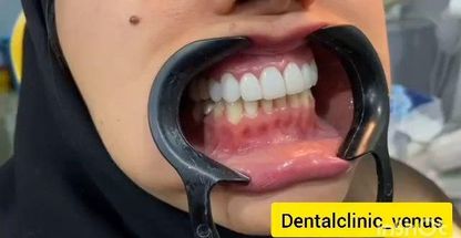 کلینیک دندانپزشکی ونوس (شعبه پاسداران)