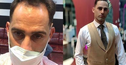 پیرایش مدرن زعفرانیه(مهدی مهری)