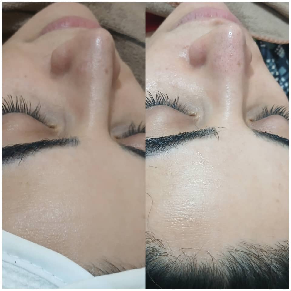 کلینیک تخصصی پاکسازی و فیشیال پوست زارعی