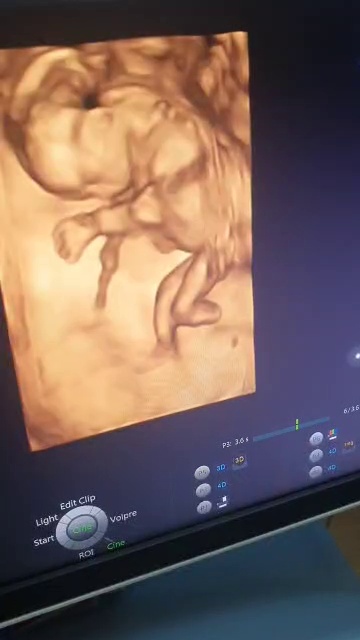 سونوگرافی رادیولوژی مرکزی اصفهان