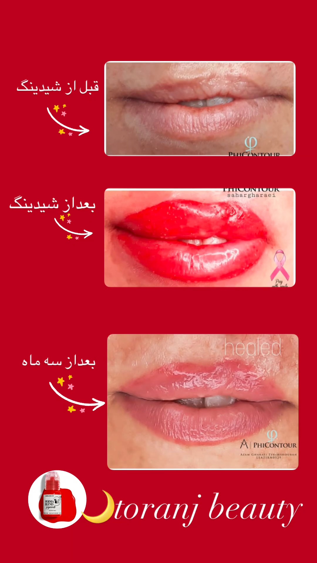 مرکز میکرو و ریمو تتو سحر قرائی