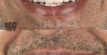 مطب دندانپزشکی دکتر پدرام عبداله زاده