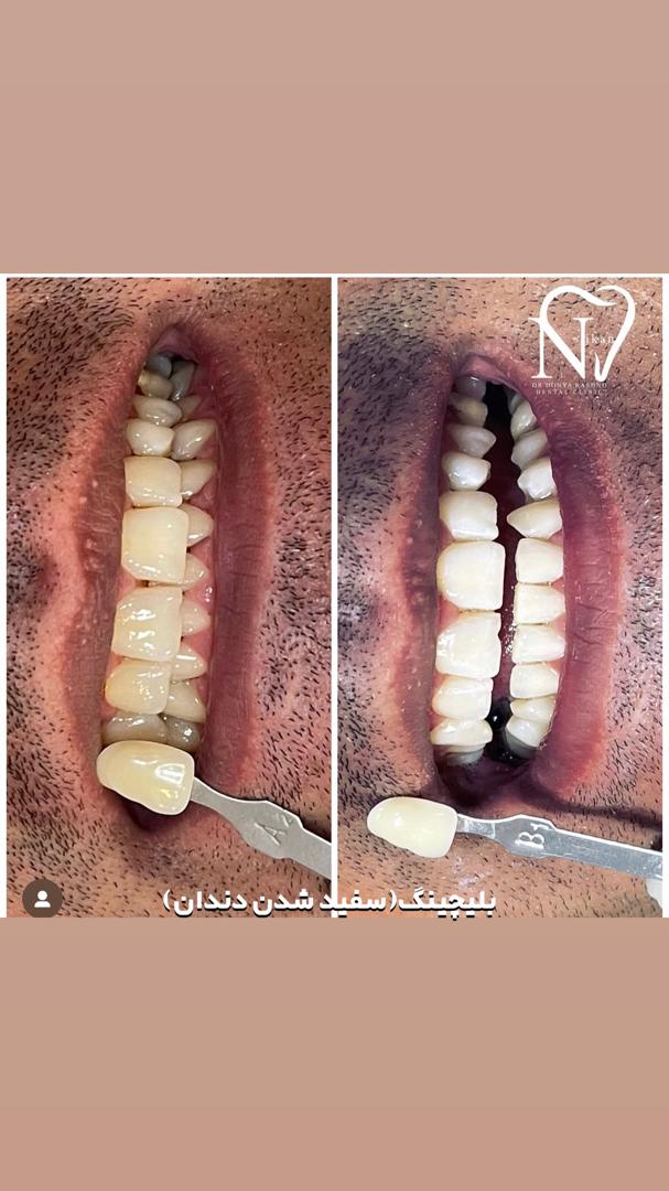 کلینیک دندانپزشکی دکتر دنیا رشنو(نیکان)