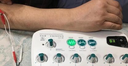 فیزیوتراپی پرتو