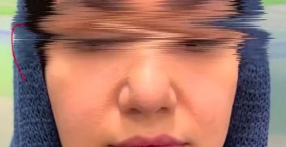 مرکز لیزر و کلینیک زیبایی الیسو