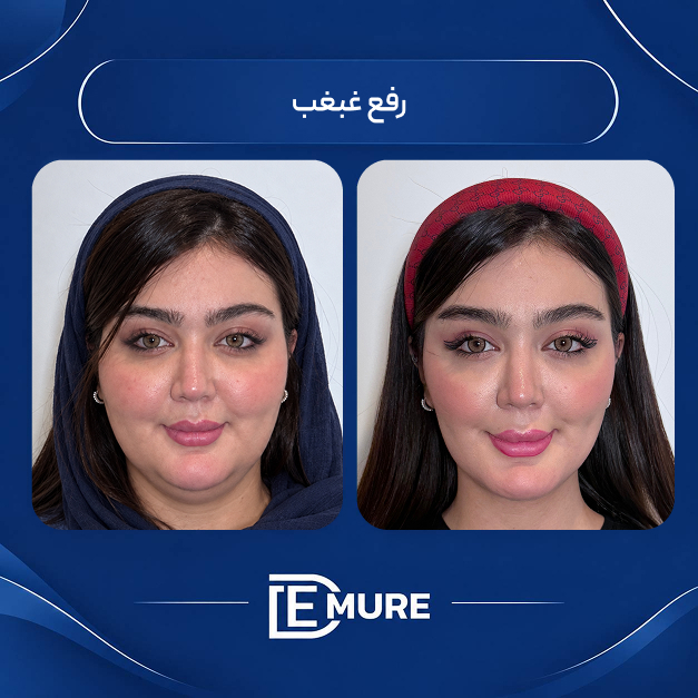 مرکز تخصصی لاغری دمور
