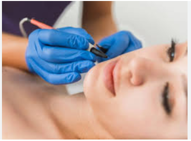 لیزر و لاغری موضعی نگار