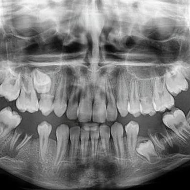 کلینیک تخصصی سی تی اسکن و ام آر آی آبان