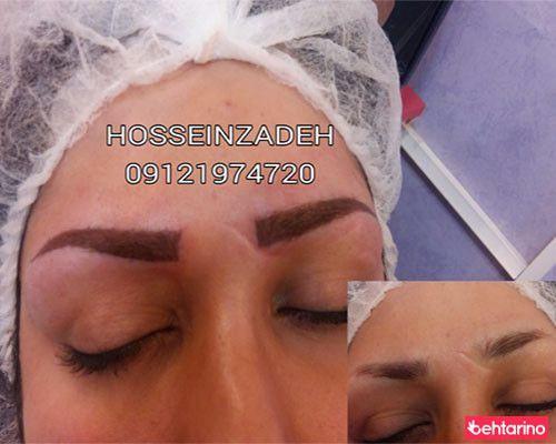 مرکز تخصصی میکروپیگمنتیشن اکباتان