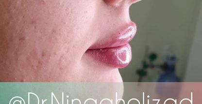 کلینیک زیبایی دکتر نینا قلی زاد