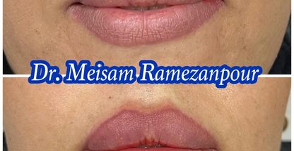 دکتر پوست مو زیبایی میثم رمضانپور خاکی