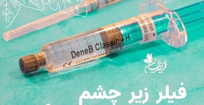 کلینیک کاشت مو ایرانیان