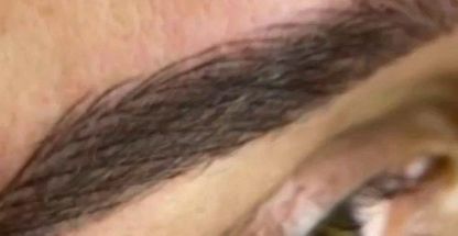 میکروبلیدینگ و میکروپیگمنتیشن مریم