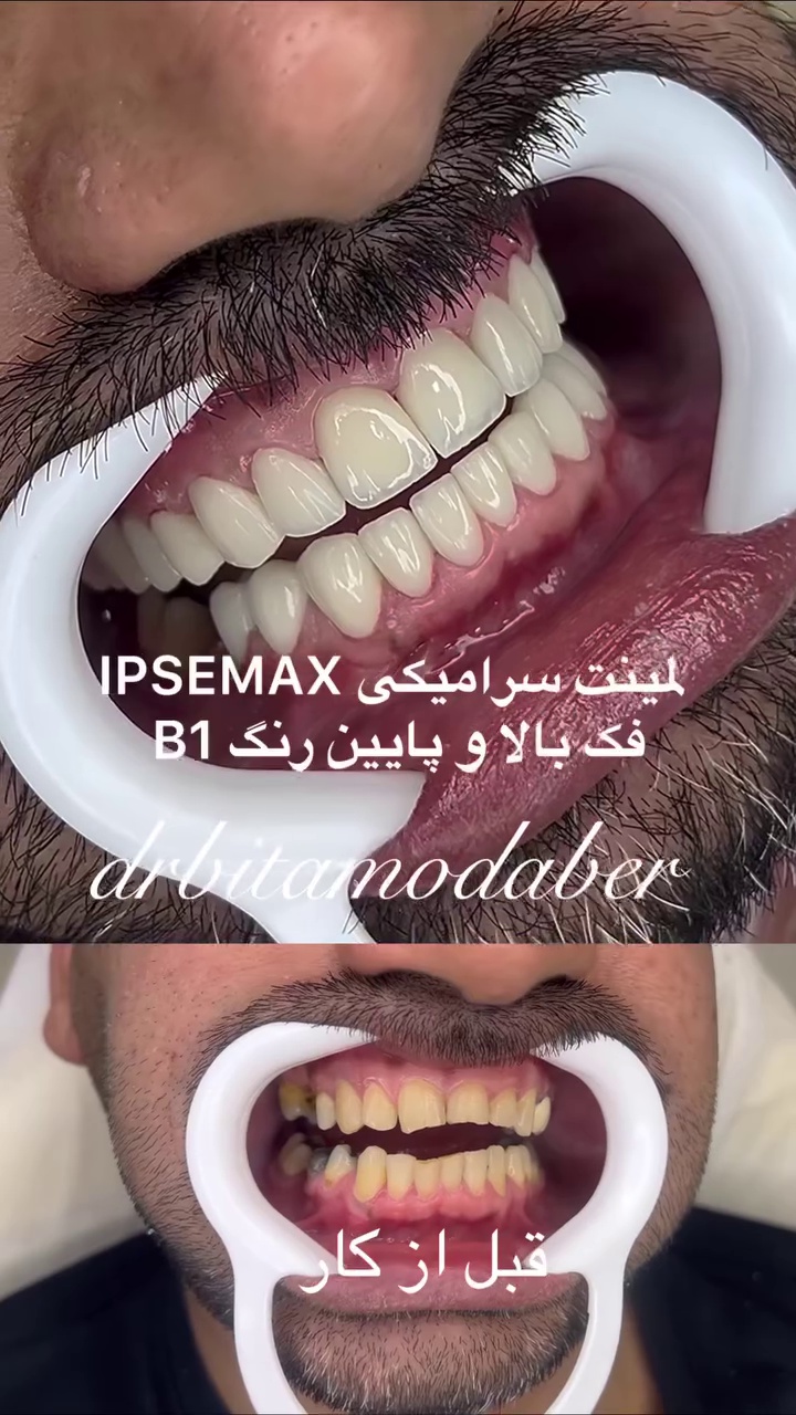دندانپزشکی دکتر بیتا مدبّر