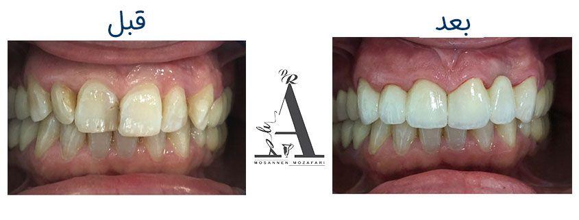 مرکز دندانپزشکی، دندانسازی مظفری