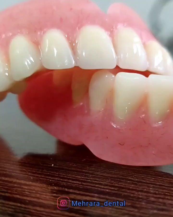 دندانسازی مهرآرا یزد