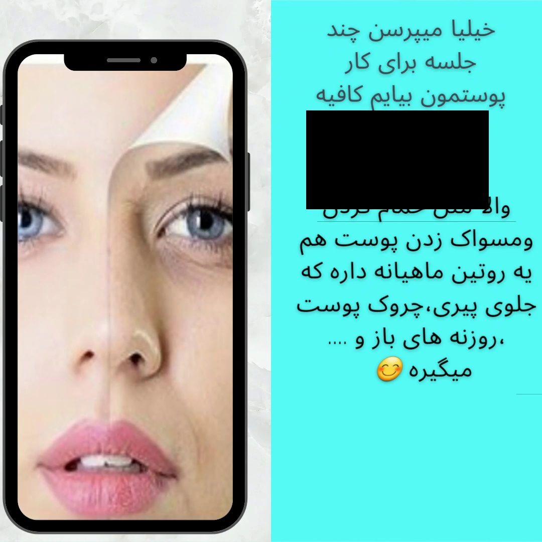 مرکز ماساژ و  فیشال  صورت