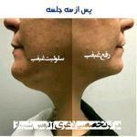 کلینیک لاغری اتوس