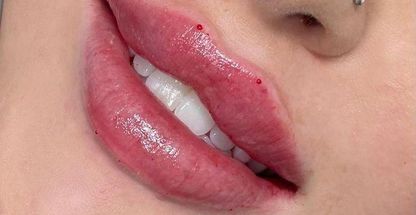 مرکز پوست مو زیبایی و لیزر شارلوت