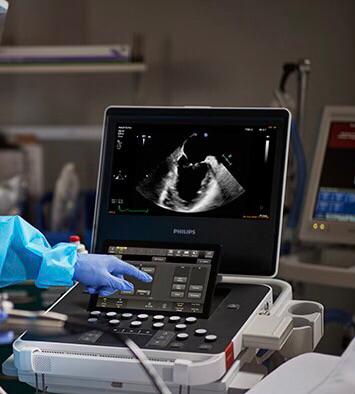 برد تخصصی قلب و عروق