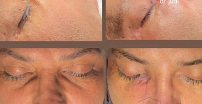 دکتر رضا جودی (جراح بینی در زعفرانیه)