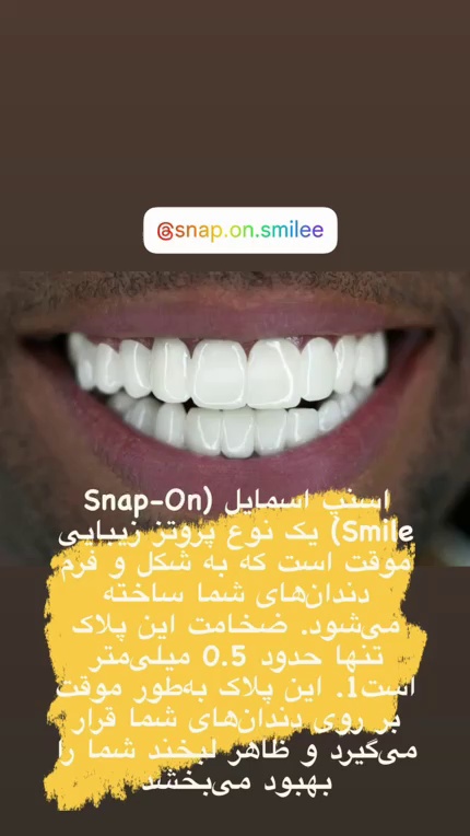 خدمات دندانسازی و اسنپ اسمایل بهشتی