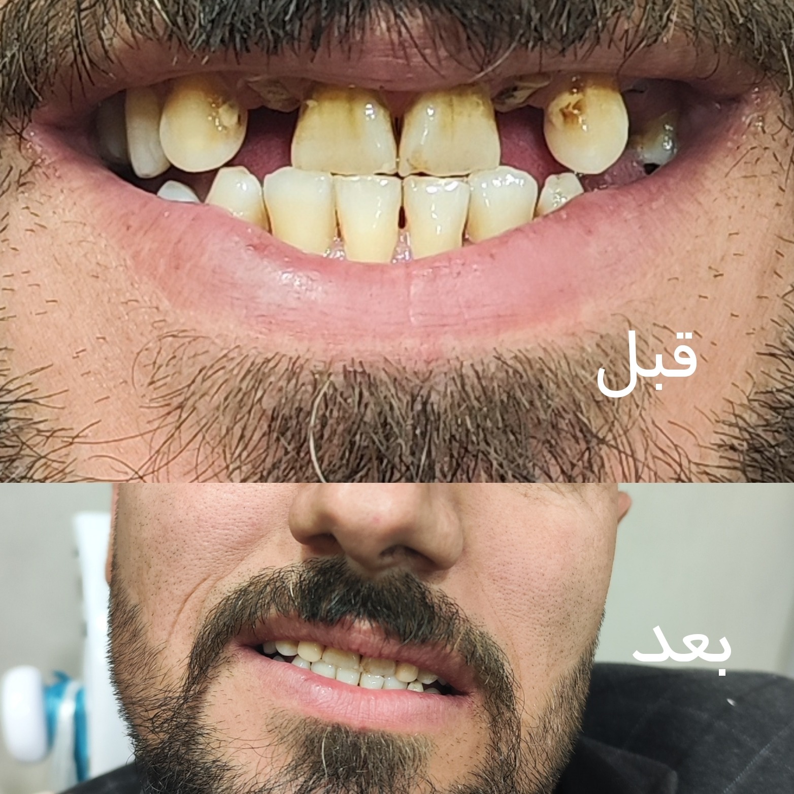 دندانسازی حبیبی
